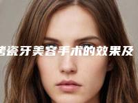 烤瓷牙美容手术的效果及优点,烤瓷牙美容有哪些特点和效果