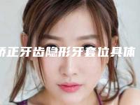 矫正牙齿隐形牙套位具体适用的人群是哪些