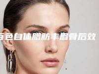 百色自体脂肪丰眉骨后效果持久吗