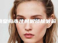 秦皇岛市注射眼部除皱前十排名新参考-秦皇岛市注射眼部除皱整形医院