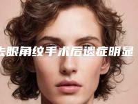 去眼角纹手术后遗症明显吗-去眼角纹手术会不会出现后遗症呢