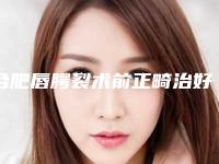 合肥唇腭裂术前正畸治好不好,价格贵不贵