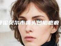 呼伦贝尔市鼻头凹陷疤痕修复医生上榜清单前十哪几个可靠-呼伦贝尔市鼻头凹陷疤痕修复整形医生