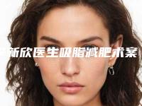 李新欣医生吸脂减肥术案例-价格表详细医生完整曝光一览