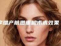李增产航道重睑术术效果究竟如何