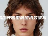 松原牙侧面龋齿术效果与哪些因素有关