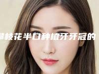 攀枝花半口种植牙牙冠的术后护理有什么