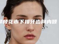 攀枝花市下排牙齿向内倾斜上榜清单专位真不错-攀枝花市下排牙齿向内倾斜口腔医生
