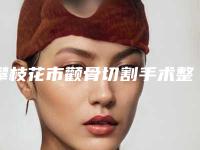 攀枝花市颧骨切割手术整形医院(川西医学美容诊所收费不贵哦)