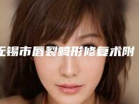 无锡市唇裂畸形修复术附医院全新价格表-无锡市唇裂畸形修复术费用是要多少钱