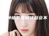 汕头种植牙塑钢牙冠会不会有什么副作用