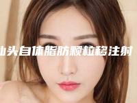 汕头自体脂肪颗粒移注射隆胸要多少价格