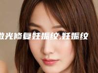 激光修复妊娠纹,妊娠纹激光消除是假的