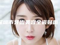 深圳市牙齿美容全瓷贴面颗医院排行榜前十位哪家强(深圳市牙齿美容全瓷贴面颗口腔医院口碑擅长各不同)