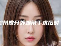 湖州做开外眼角手术后对生活会有什么影响