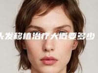 头发移植治疗大概要多少钱