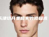天津切开重睑失败修复术手术不适合什么人群