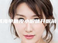 威海单眼皮小眼睛开眼角整形手术效果自然