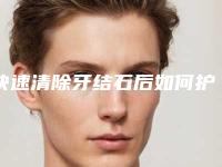 快速清除牙结石后如何护理恢复得快