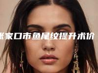 张家口市鱼尾纹提升术价格(费用)清单(鱼尾纹提升术均价为:3719元)