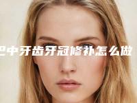 巴中牙齿牙冠修补怎么做才比较安全