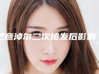 巴彦淖尔二次植发后影响生育吗
