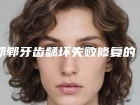 邯郸牙齿龋坏失败修复的适宜人群有哪些