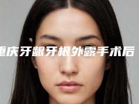 重庆牙龈牙根外露手术后遗症的危害有哪些