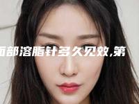 面部溶脂针多久见效,第一针脸部溶脂针多久见效