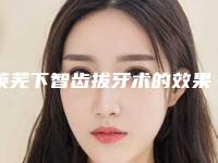 莱芜下智齿拔牙术的效果好不好