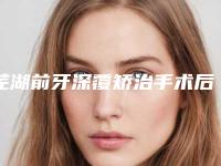 芜湖前牙深覆矫治手术后出现后遗症怎么处理