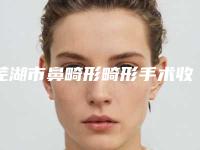 芜湖市鼻畸形畸形手术收费明细2025火热出炉(鼻畸形畸形手术价格更亲民)