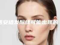 西安植发际线可能出现的危险有哪些