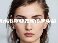 衡水市翘睫双眼皮医生前十佳排名详细分析-张明欣医生连续几年上榜