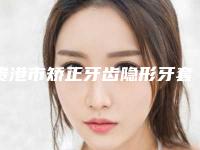 贵港市矫正牙齿隐形牙套医生上榜清单前十佳网友良心盛赞-贵港市矫正牙齿隐形牙套口腔医生