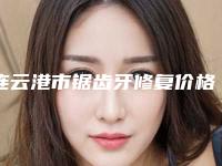 连云港市锯齿牙修复价格(价目)及案例抢先看-连云港市锯齿牙修复价格
