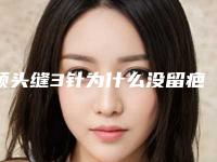 额头缝3针为什么没留疤,小孩额头缝针恢复图片