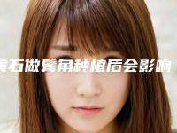 黄石做鬓角种植后会影响日常工作吗