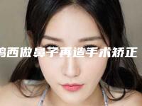 鸡西做鼻子再造手术矫正手术注意事项和术后护理