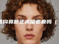 鹰钩鼻矫正术留疤痕吗(鹰钩鼻矫正术后照片)